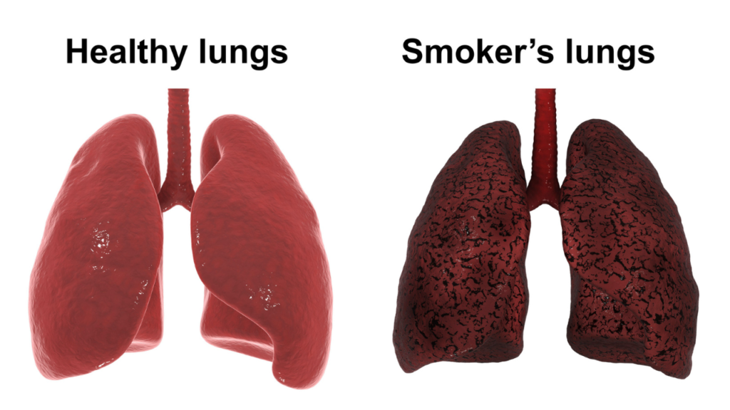 how to clean lungs after quitting smoking