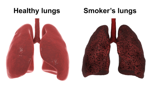 How To Clean Lungs After Quitting Smoking 2023